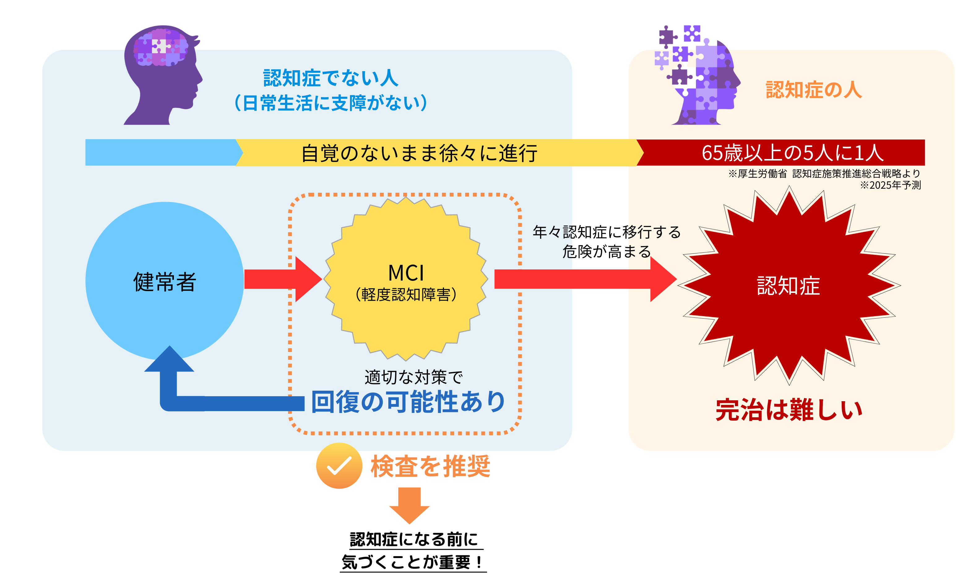 ”軽度認知障害(MCI)とは”/